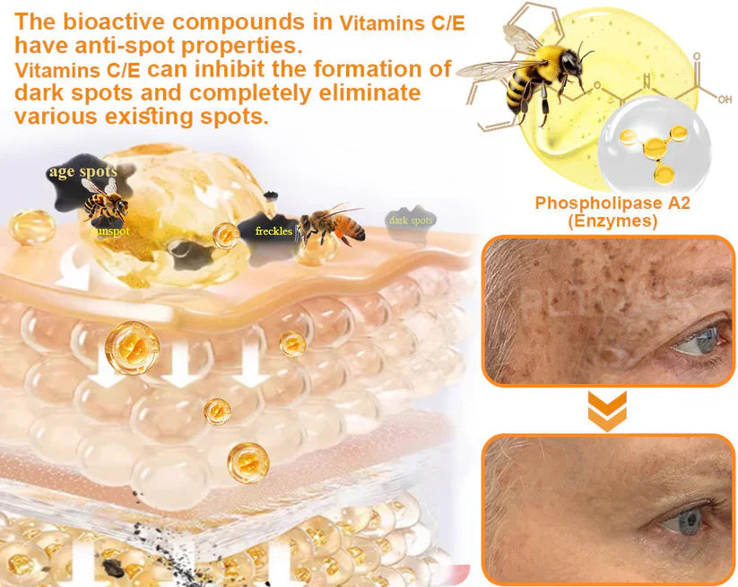 Bee Venom Skin Treatment Cream (Buy 1 Get 1 Free)