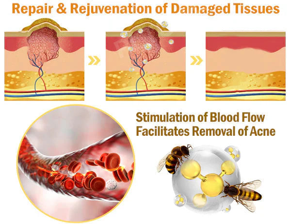 Bee Venom Skin Treatment Cream (Buy 1 Get 1 Free)