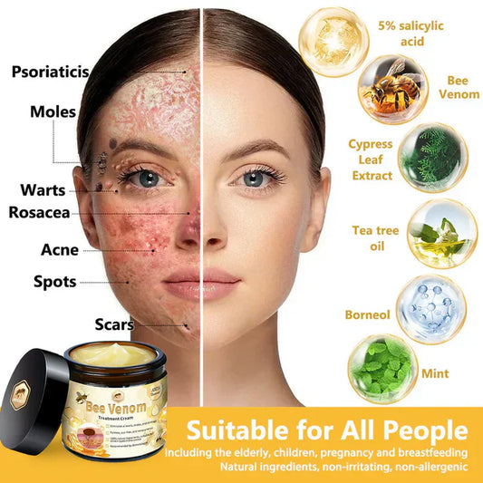 Bee Venom Skin Treatment Cream (Buy 1 Get 1 Free)