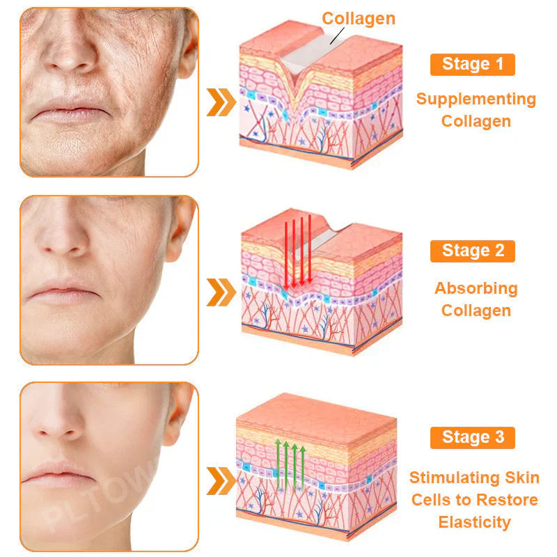 Bee Venom Skin Treatment Cream (Buy 1 Get 1 Free)