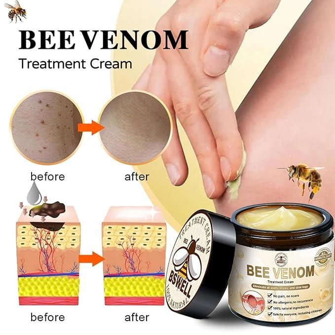 Bee Venom Skin Treatment Cream (Buy 1 Get 1 Free)