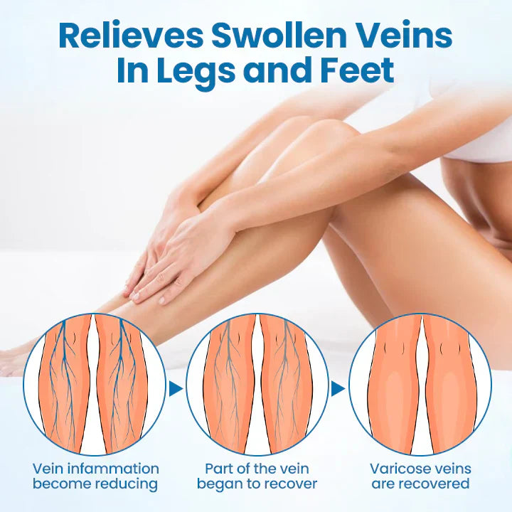 Timilk® VeinGuard Herbal Spray (BUY 1 GET 1 FREE)