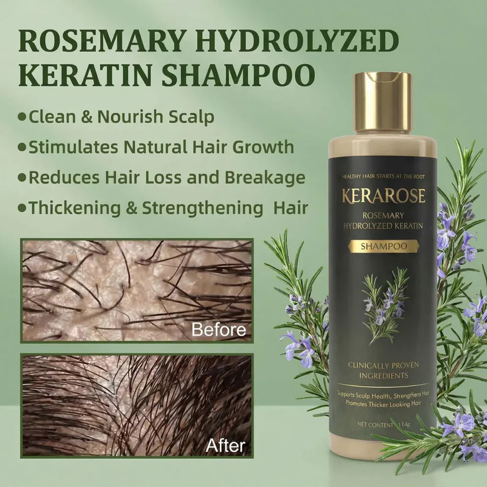 Kerarose Rosemary Shampoo For Hair Growth (Buy 1 Get 1 Free 🔥🔥)