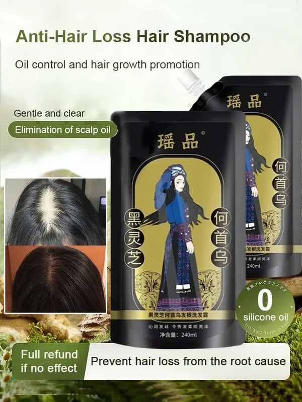 Ginger Plant Extract Anti-Hair Loss Hair Shampoo (PACK OF 4)